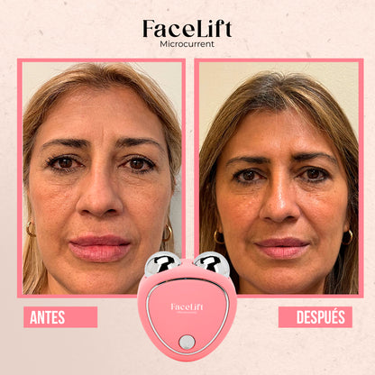 FaceLift - Masajeador Facial HV Microcorriente