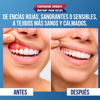 Tooth Relief Spray™ Alivio inmediato, sonrisa asegurada.